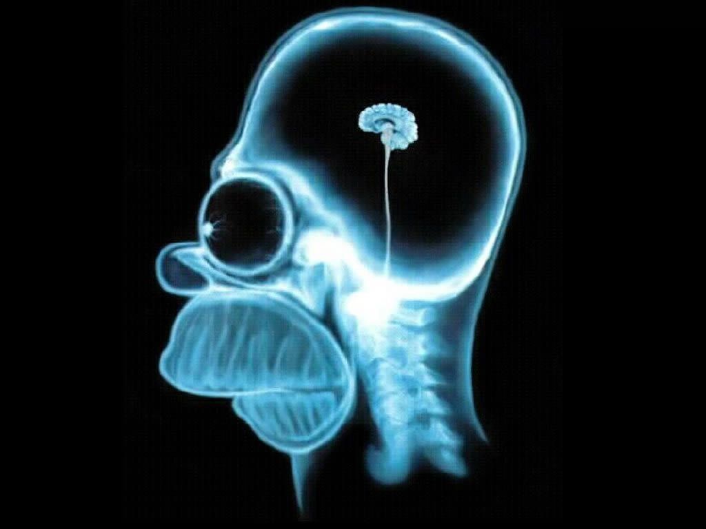 Homer Brain X Ray - The Simpsons Wallpaper 60337 - Fanpop